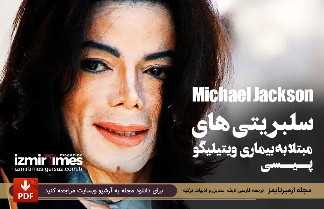 مایکل جکسون (Michael Jackson) افراد مشهور مبتلا به ویتیلیگو (پیسی)